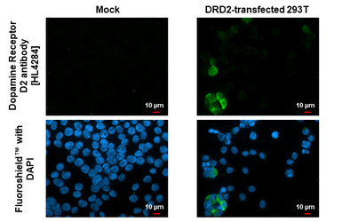 Anti-Dopamine Receptor D2 antibody [HL4284] used in Immunocytochemistry/ Immunofluorescence (ICC/IF). GTX643524