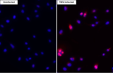 Anti-Tick-borne encephalitis virus (TBEV) Capsid antibody [HL4292] used in Immunocytochemistry/ Immunofluorescence (ICC/IF). GTX643532