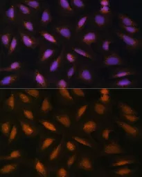 Anti-FGF2 antibody used in Immunocytochemistry/ Immunofluorescence (ICC/IF). GTX64354
