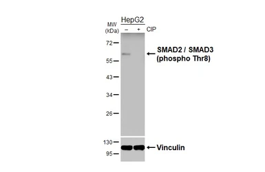 Anti-SMAD2 / SMAD3 (phospho Thr8) antibody [HL4326] used in Western Blot (WB). GTX643573