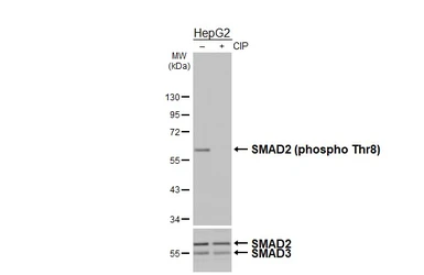 Anti-SMAD2 / SMAD3 (phospho Thr8) antibody [HL4327] used in Western Blot (WB). GTX643574