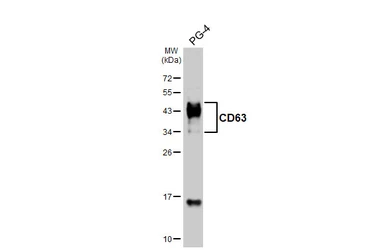 Anti-CD63 antibody [HL4361] used in Western Blot (WB). GTX643611