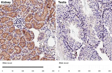 Anti-CD63 antibody [HL4361] used in IHC (Paraffin sections) (IHC-P). GTX643611