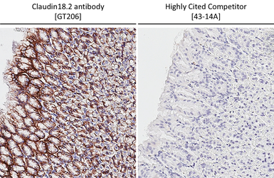 Anti-Claudin 18.2 antibody [GT206] used in IHC (Paraffin sections) (IHC-P). GTX643617