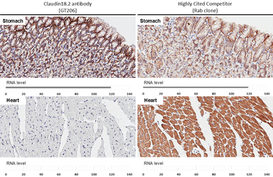 Anti-Claudin 18.2 antibody [GT206] used in IHC (Paraffin sections) (IHC-P). GTX643617