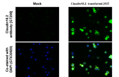 Anti-Claudin 18.2 antibody [GT206] used in IHC-P (cell pellet) (IHC-P (cell pellet)). GTX643617