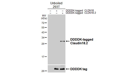 Anti-Claudin 18.2 antibody [GT206] used in  (). GTX643617