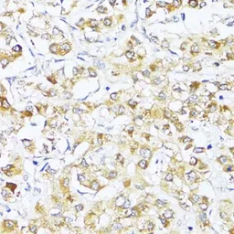 Anti-eIF2 alpha antibody used in IHC (Paraffin sections) (IHC-P). GTX64363