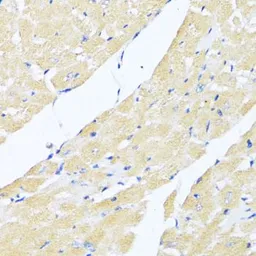 Anti-eIF2 alpha antibody used in IHC (Paraffin sections) (IHC-P). GTX64363