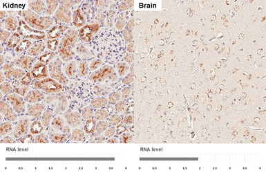 Anti-GALNT2 antibody [HL4377] used in IHC (Paraffin sections) (IHC-P). GTX643634