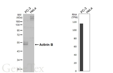 Anti-Inhibin beta B antibody [HL4390] used in Western Blot (WB). GTX643647