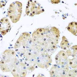 Anti-NuMA antibody used in IHC (Paraffin sections) (IHC-P). GTX64368