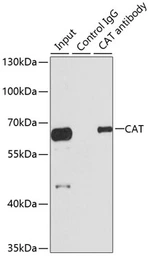Anti-Catalase antibody used in Immunoprecipitation (IP). GTX64374