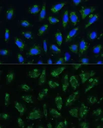 Anti-Apolipoprotein B antibody used in Immunocytochemistry/ Immunofluorescence (ICC/IF). GTX64377