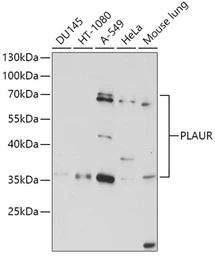 Anti-uPAR antibody used in Western Blot (WB). GTX64381