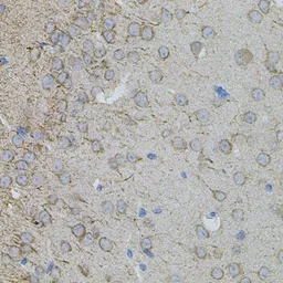 Anti-MMP10 antibody used in IHC (Paraffin sections) (IHC-P). GTX64385