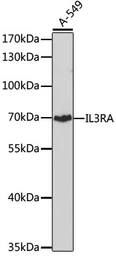 Anti-IL3 Receptor alpha antibody used in Western Blot (WB). GTX64388