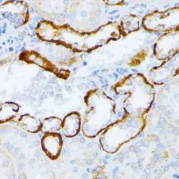Anti-IL3 Receptor alpha antibody used in IHC (Paraffin sections) (IHC-P). GTX64388