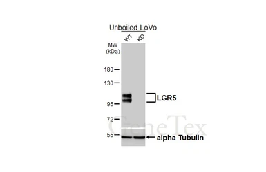 Anti-LGR5 antibody [HL4443] used in Western Blot (WB). GTX644008