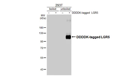 Anti-LGR5 antibody [HL4443] used in Western Blot (WB). GTX644008