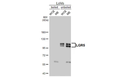 Anti-LGR5 antibody [HL4443] used in Western Blot (WB). GTX644008