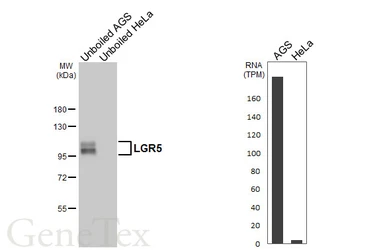 Anti-LGR5 antibody [HL4443] used in Western Blot (WB). GTX644008