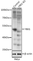 Anti-YB1 antibody used in Western Blot (WB). GTX64401