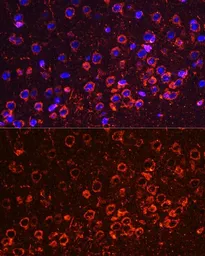 Anti-YB1 antibody used in IHC (Paraffin sections) (IHC-P). GTX64401