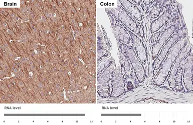 Anti-SLC38A1 antibody [HL4453] used in IHC (Paraffin sections) (IHC-P). GTX644018