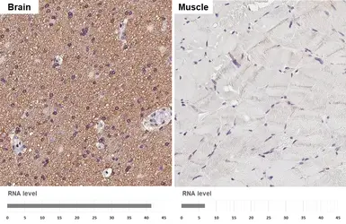 Anti-SLC38A1 antibody [HL4453] used in IHC (Paraffin sections) (IHC-P). GTX644018