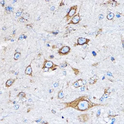 Anti-Cathepsin B antibody used in IHC (Paraffin sections) (IHC-P). GTX64404