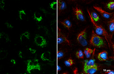 Anti-VDAC2 antibody [HL4477] used in Immunocytochemistry/ Immunofluorescence (ICC/IF). GTX644044