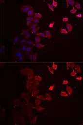 Anti-P2X4 antibody used in Immunocytochemistry/ Immunofluorescence (ICC/IF). GTX64406