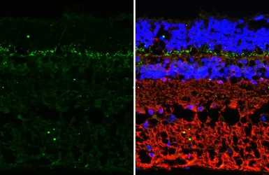 Anti-mGluR6 antibody [HL4516] used in IHC (Paraffin sections) (IHC-P). GTX644086