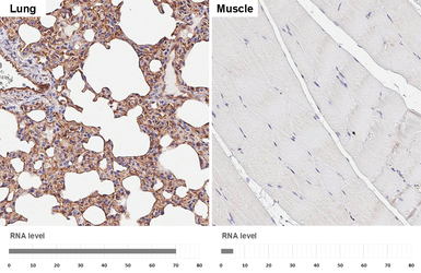 Anti-CD9 antibody [HL4525] used in IHC (Paraffin sections) (IHC-P). GTX644095