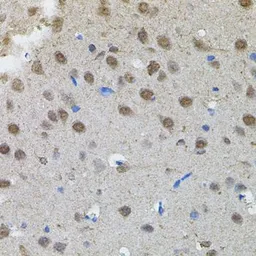 Anti-n-Myc antibody used in IHC (Paraffin sections) (IHC-P). GTX64413