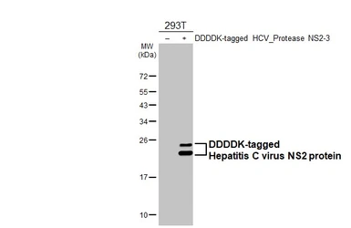 Anti-Hepatitis C virus NS2 protein antibody [HL4539] used in Western Blot (WB). GTX644207