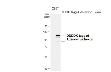 Anti-Adenovirus hexon antibody [HL4593] used in Western Blot (WB). GTX644269