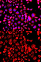 Anti-Eotaxin antibody used in Immunocytochemistry/ Immunofluorescence (ICC/IF). GTX64437