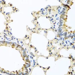 Anti-Eotaxin antibody used in IHC (Paraffin sections) (IHC-P). GTX64437