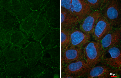 Anti-Desmocollin 2 antibody [HL4655] used in Immunocytochemistry/ Immunofluorescence (ICC/IF). GTX644508