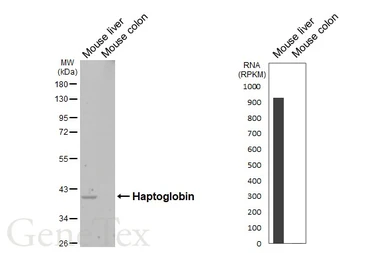 Anti-Haptoglobin antibody [HL4637] used in Western Blot (WB). GTX644510