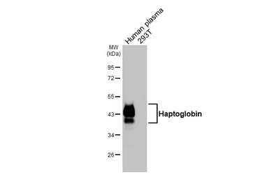 Anti-Haptoglobin antibody [HL4637] used in Western Blot (WB). GTX644510