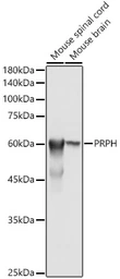 Anti-Peripherin antibody used in Western Blot (WB). GTX64462