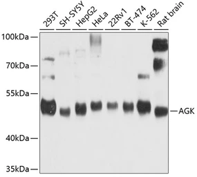 Anti-Acylglycerol kinase antibody used in Western Blot (WB). GTX64463