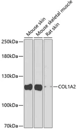 Anti-COL1A2 antibody used in Western Blot (WB). GTX64468