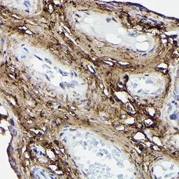 Anti-COL1A2 antibody used in IHC (Paraffin sections) (IHC-P). GTX64468