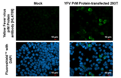 Anti-Yellow Fever virus prM Protein antibody [HL4709] used in Immunocytochemistry/ Immunofluorescence (ICC/IF). GTX644710