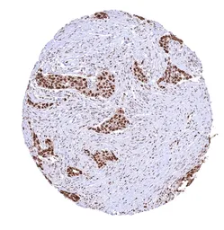Anti-PCNA antibody [HMV4714] HistoMAX&trade; used in IHC (Paraffin sections) (IHC-P). GTX644715
