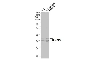 Anti-FOXP3 antibody [HL4717] used in Western Blot (WB). GTX644721